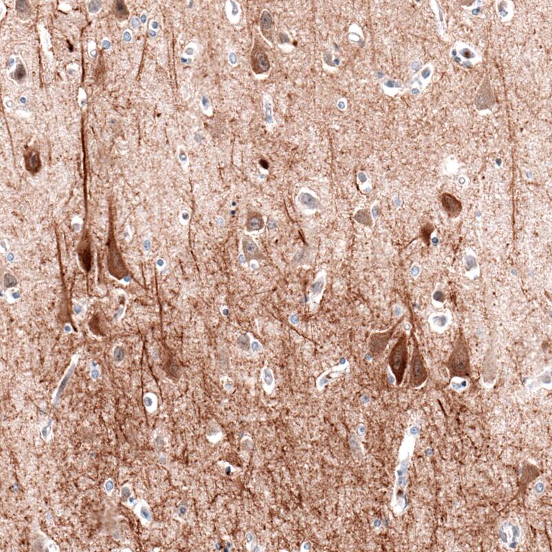 Staining of human cerebral cortex shows cytoplasmic immunoreactivity in neurons, as well as positivity in neuropil.