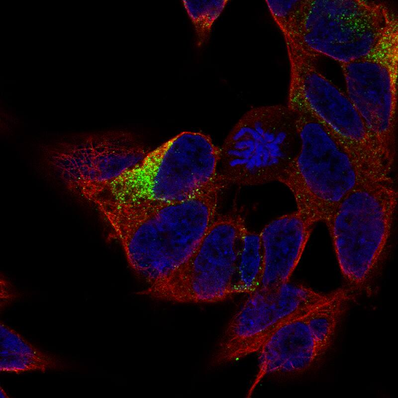 Staining of SH-SY5Y cells using the Anti-MAP2 monoclonal antibody) . 