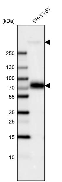 Analysis in human cell line SH-SY5Y.