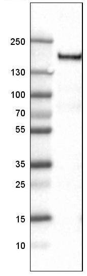 Lane 1: Marker [kDa]Lane 2: Human tonsil