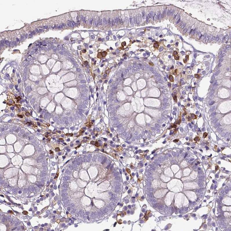 Staining of human colon shows moderate membranous positivity in lymphoid cells.