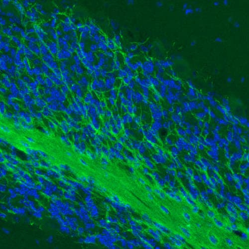 Staining of mouse cerebellum shows strong immunoreactivity in myelinated neural processes.