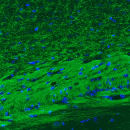 Staining of mouse corpus callosum shows strong immunoreactivity in myelinated neural fibers.