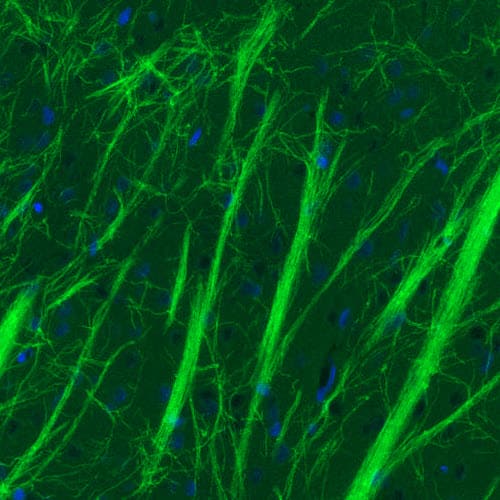 Staining of rat striatum shows strong positivity in myelinated neural processes.