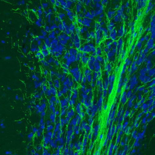 Staining of rat cerebellum shows strong immunoreactivity in myelinated neural fibers.