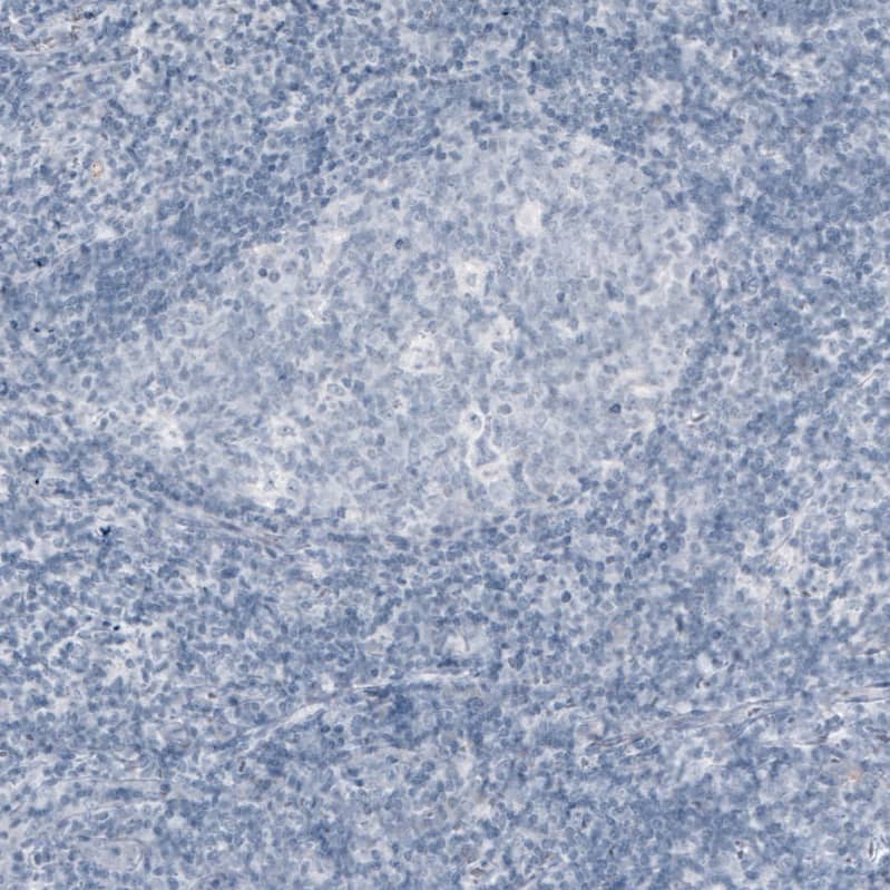 Staining of human tonsil shows no positivity in lymphoid cells as expected.