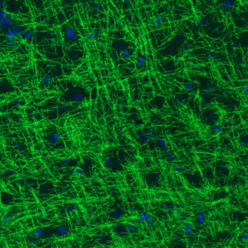 Staining of rat cerebral cortex shows strong immunoreactivity in myelinated neural fibers.