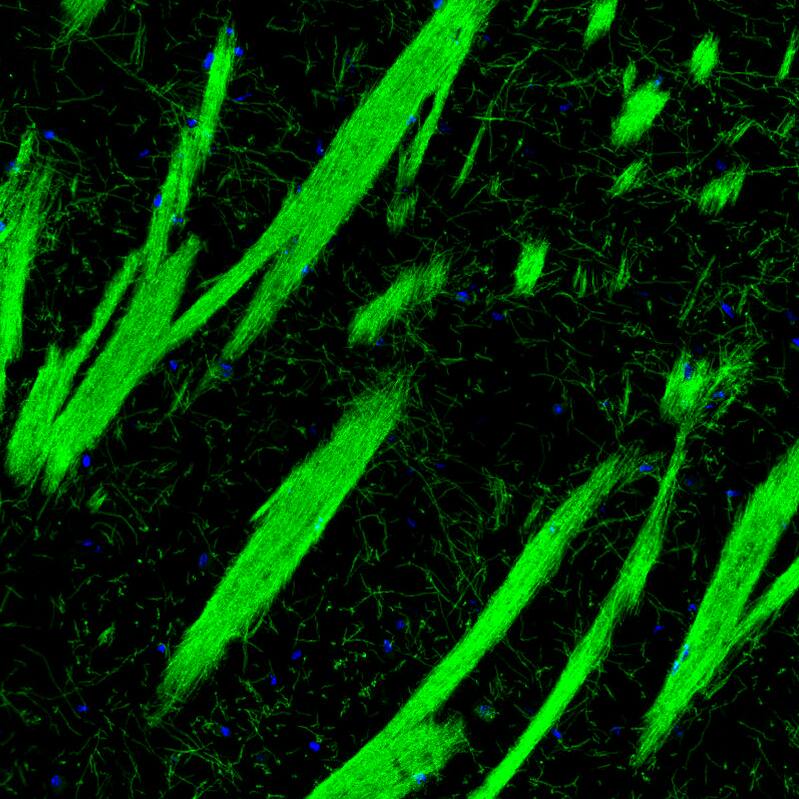 Staining of mouse basal forebrain shows strong positivity in myelinated neural fibers in the caudate putamen.