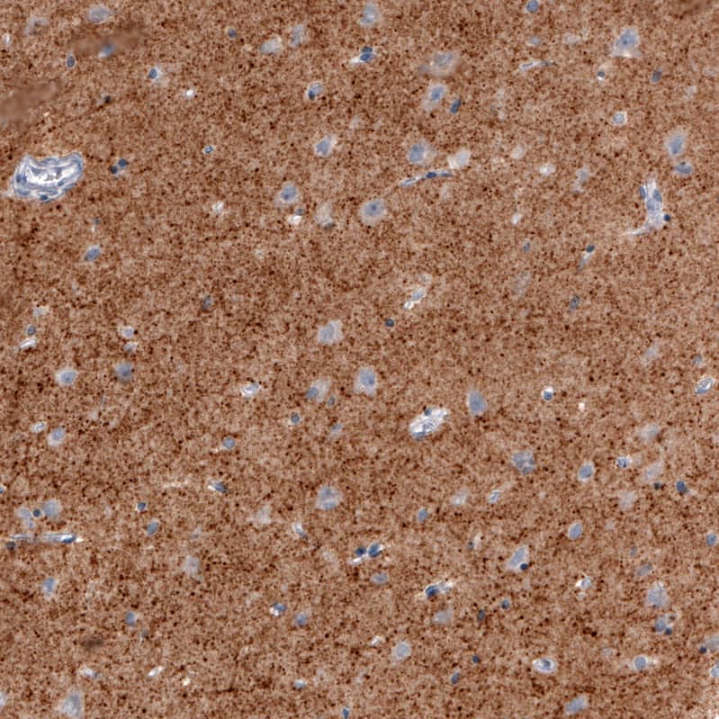 Staining of human cerebral cortex shows strong positivity in neuropil.