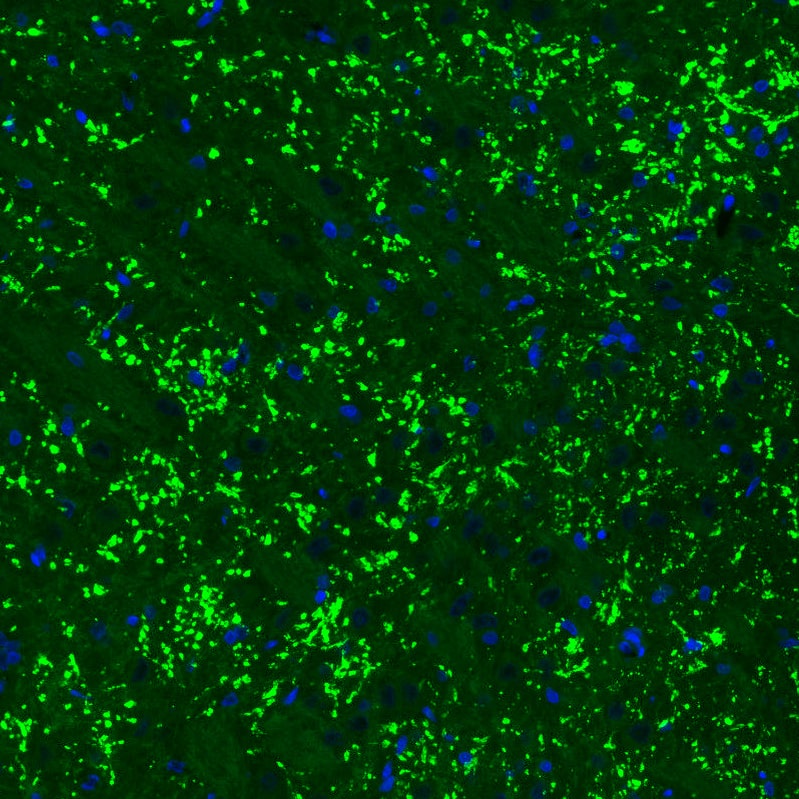 Staining of rat brain shows strong positivity in glutamatergic synapses in the thalamus.
