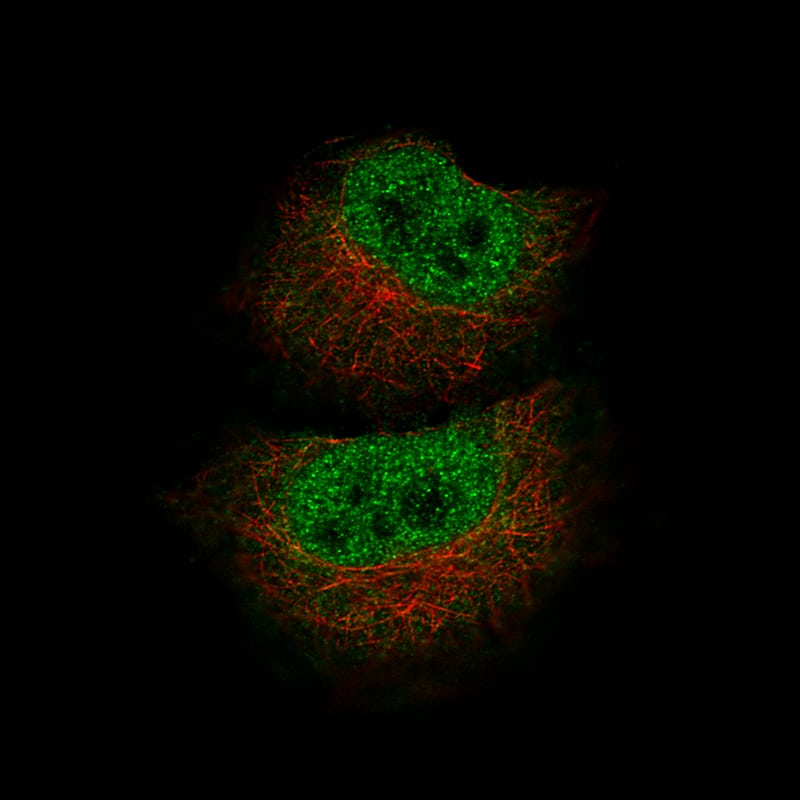 Staining of A549 cells using the Anti-MBP monoclonal antibody) .