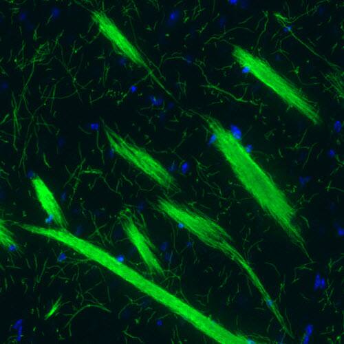 Staining of mouse striatum shows strong positivity in myelinated fibers.