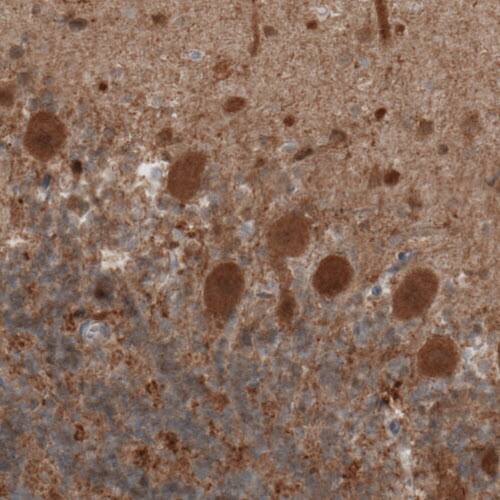 Staining of human cerebellum shows moderate positivity in Purkinje cells.
