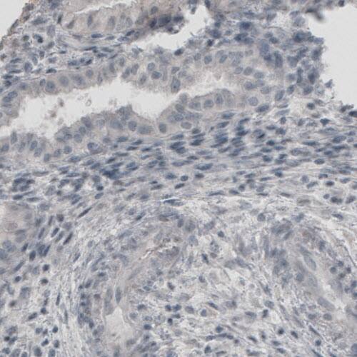 Staining of human fallopian tube shows absence of immunoreactivity (negative control).