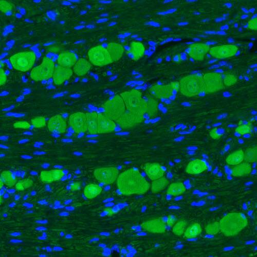 Staining of mouse trigeminal ganglion shows strong immunoreactivity in primary sensory neurons.