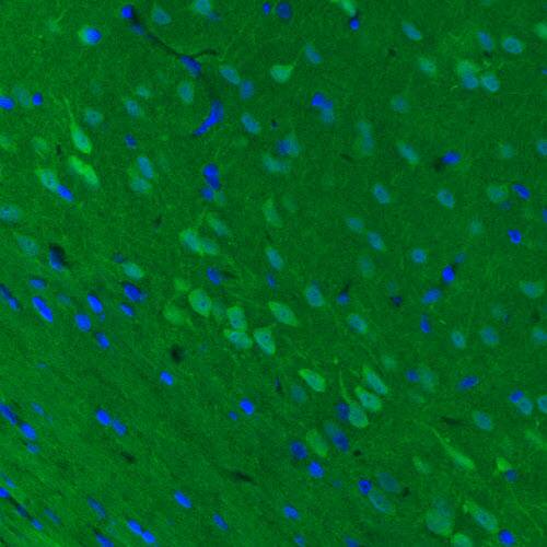 Staining of rat cerebral cortex shows moderate immunoreactivity in neurons.