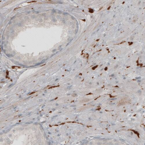 Staining of human prostate shows staining in peripheral nerve fibers.
