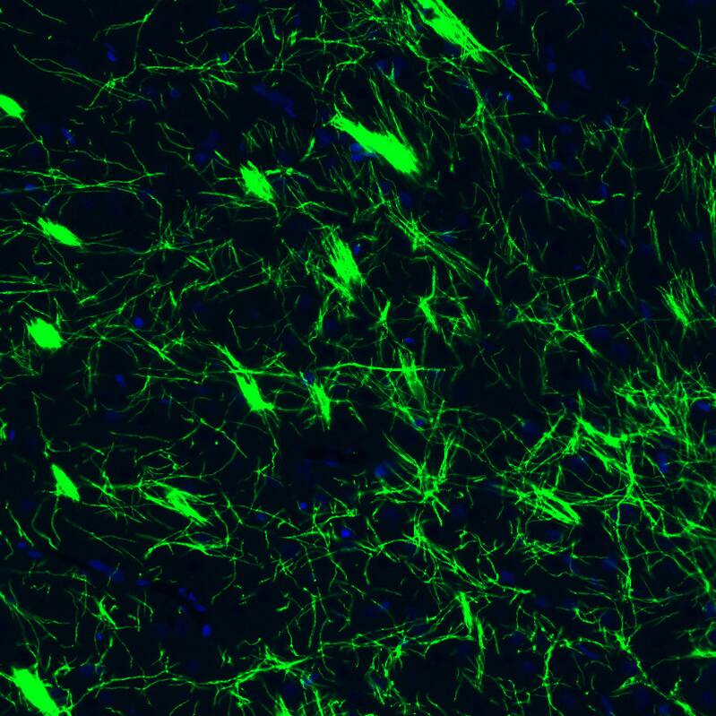 Staining of rat basal forebrain shows strong positivity in myelinated neural fibers.