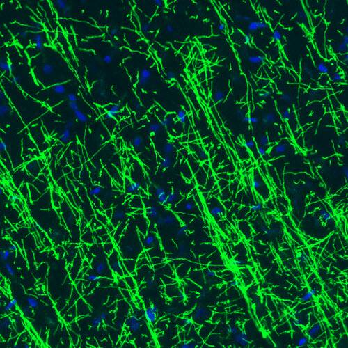 Staining of rat cerebral cortex shows strong immunoreactivity in myelinated fibers.