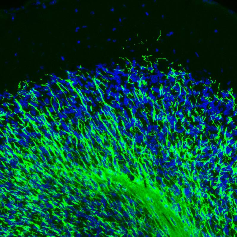 Staining of mouse cerebellum shows strong positivity in myelinated neural fibers.