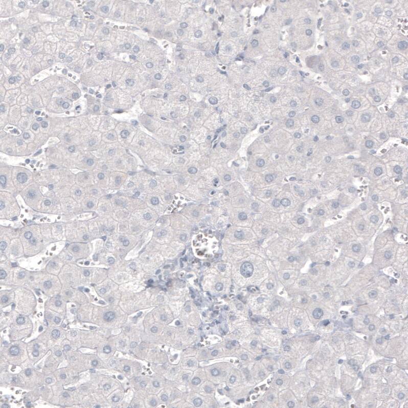 Staining of human liver shows no positivity in hepatocytes as expected.