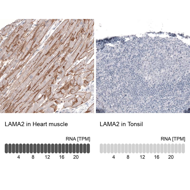 Immunohistochemistry-Paraffin Laminin alpha 2 Antibody (CL3450) - Azide and BSA Free