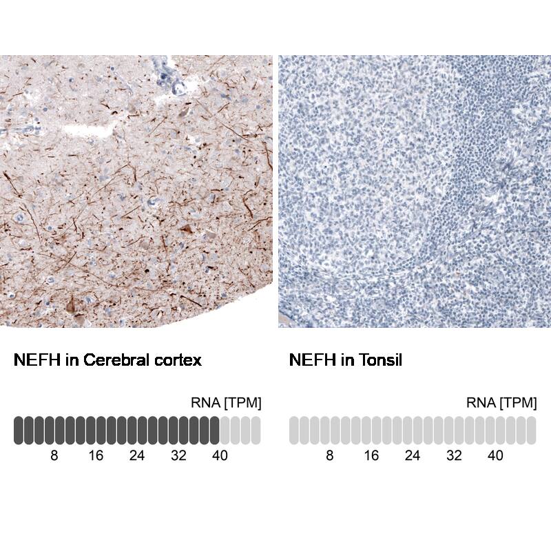 Analysis in human cerebral cortex and tonsil tissues using NBP3-43795 antibody. Corresponding NF-H RNA-seq data are presented for the same tissues.