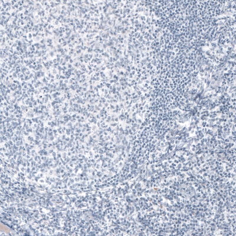 Staining of human tonsil shows no positivity in lymphoid cells as expected.