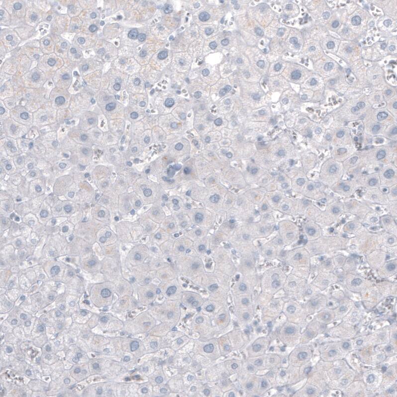 Staining of human liver shows no positivity in hepatocytes as expected.