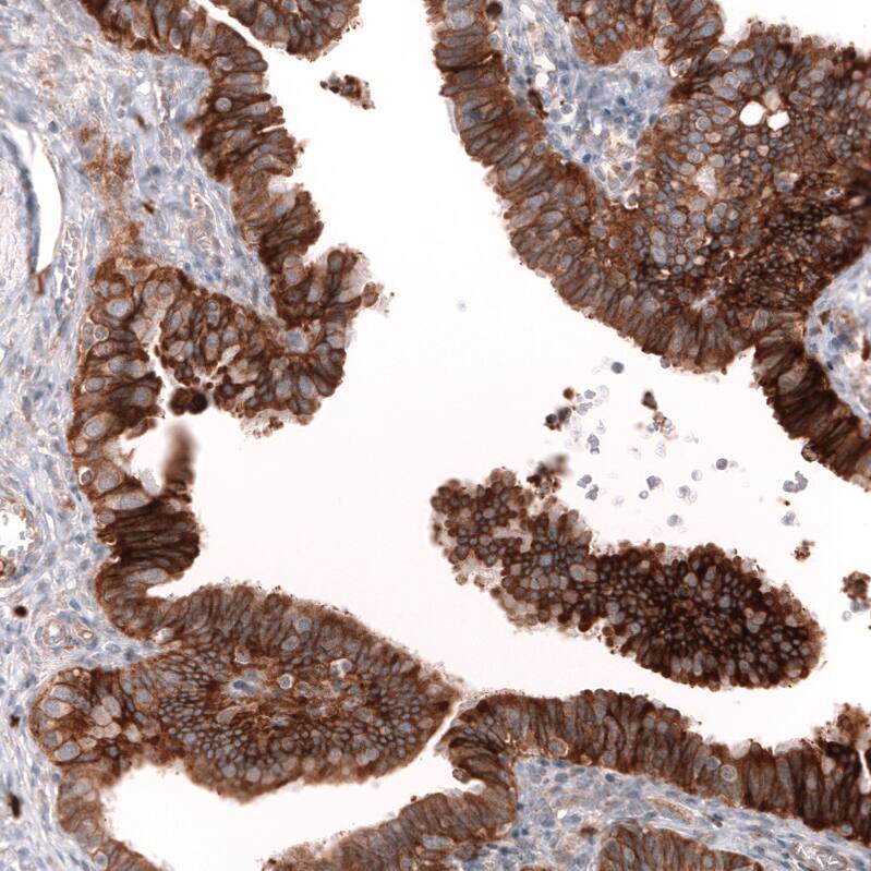 Staining of human fallopian tube shows strong membranous positivity in glandular cells.