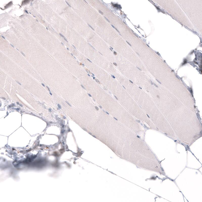 Staining of human skeletal muscle shows no positivity in myocytes as expected.