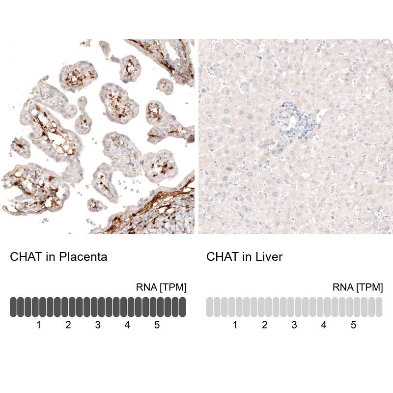 Analysis in human placenta and liver tissues using NBP3-43798 antibody. Corresponding Choline Acetyltransferase/ChAT RNA-seq data are presented for the same tissues.