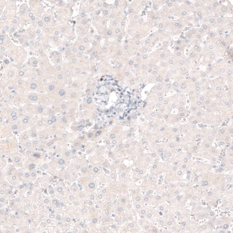 Staining of human liver shows no positivity in hepatocytes as expected.
