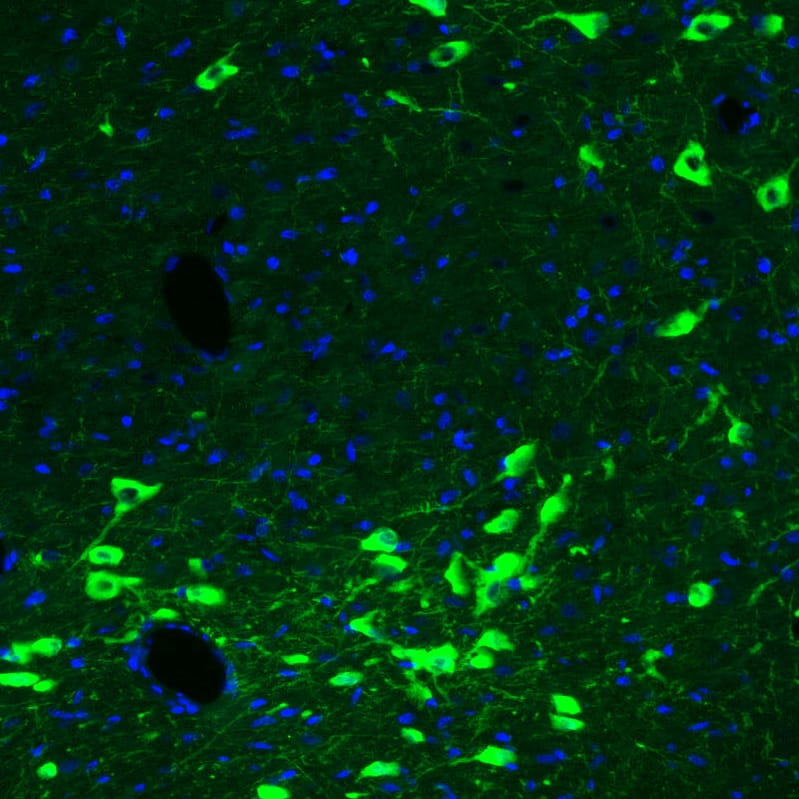 Staining of rat brain shows strong cytoplasmic positivity in acetylcholine neurons in the basal forebrain.