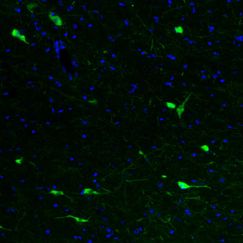 Staining of mouse brain shows strong cytoplasmic positivity in acetylcholine neurons in the basal forebrain.