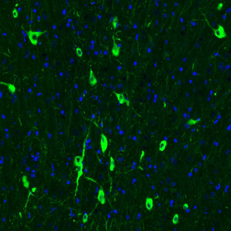 Staining of rat brain shows strong cytoplasmic positivity in acetylcholine neurons in the medial septum.