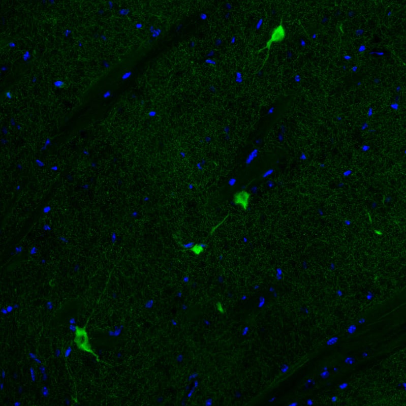 Staining of mouse basal forebrain shows strong positivity in acetylcholine neurons in the caudate putamen.