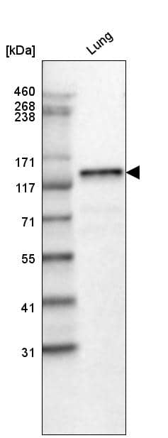 Analysis in human lung tissue.