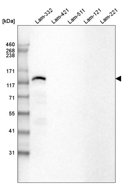 Analysis of purified human recombinant Laminin-332, Laminin-421, Laminin-511, Laminin-121 and Laminin-221.