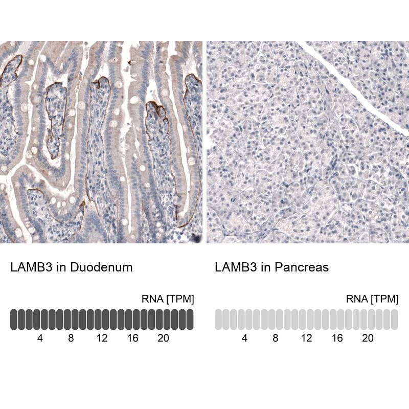 Analysis in human duodenum and pancreas tissues using NBP3-43800 antibody. Corresponding Laminin beta 3 RNA-seq data are presented for the same tissues.