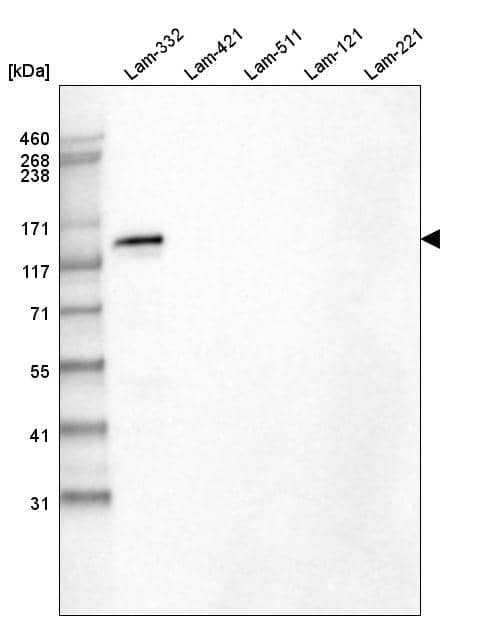 Analysis of purified human recombinant Laminin-332, Laminin-421, Laminin-511, Laminin-121 and Laminin-221.