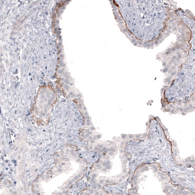 Staining of human prostate shows moderate positivity in basement membrane in glandular cells.