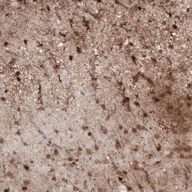 Staining of human cerebral cortex shows moderate nuclear positivity in astrocytes.