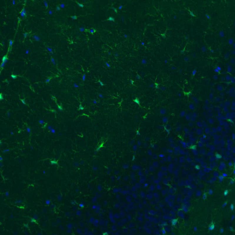 Staining of rat brain shows moderate positivity in astrocytes in the hippocampus.
