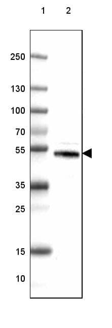 <b>Orthogonal Strategies Validation. </b>Lane 1: Marker [kDa] 250, 130, 100, 70, 55, 35, 25, 15, 10Lane 2: Human Kidney tissue