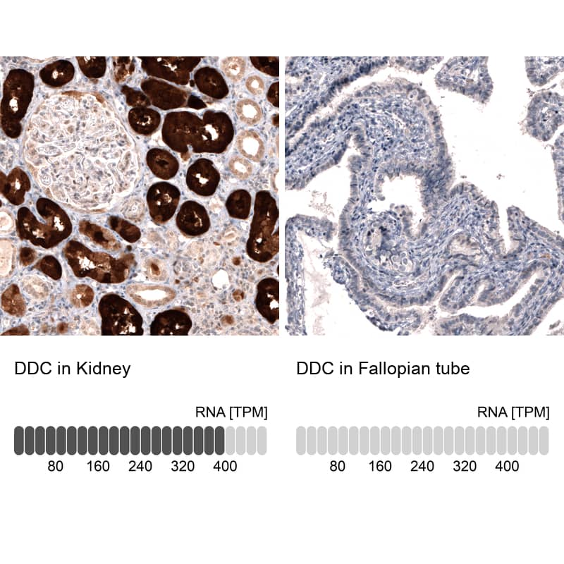 Analysis in human kidney and fallopian tube tissues using NBP3-43802 antibody. Corresponding Dopa Decarboxylase/DDC RNA-seq data are presented for the same tissues.