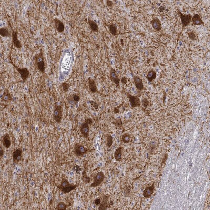 Staining of human substantia nigra shows strong cytoplasmic positivity in dopaminergic neurons.