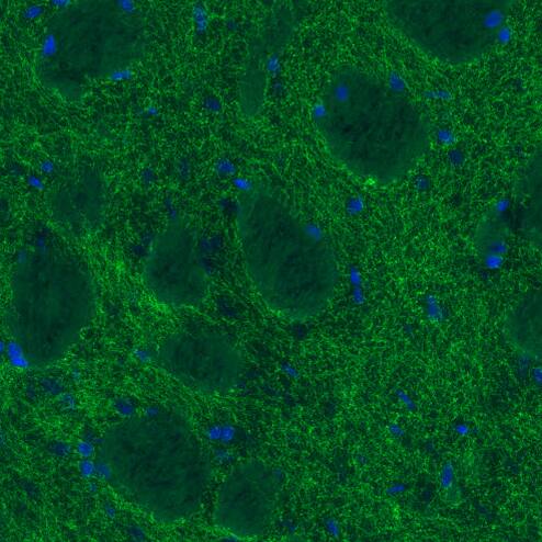 Staining of rat caudate putamen shows moderate positivity in dopaminergic fibers.