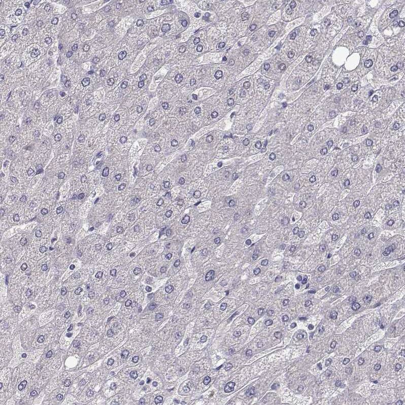 Staining of human liver shows no positivity in hepatocytes as expected.