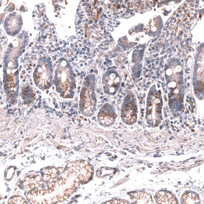 Staining of human duodenum shows moderate cytoplasmic and membranous positivity in glandular cells.